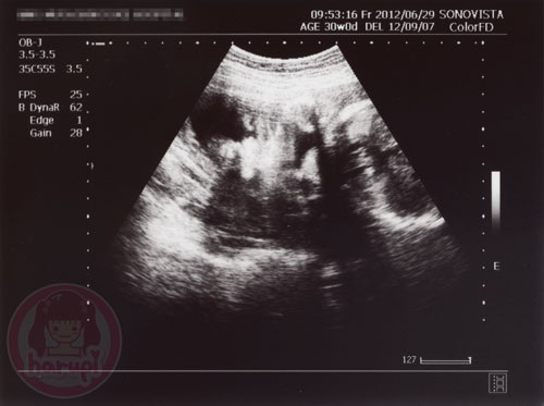 Prenatal check-up baby 30 weeks