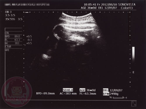 Prenatal check-up baby 36 weeks - 2